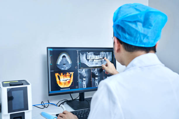 Best Emergency Dental Care for Broken or Chipped Teeth in Sunbury, PA